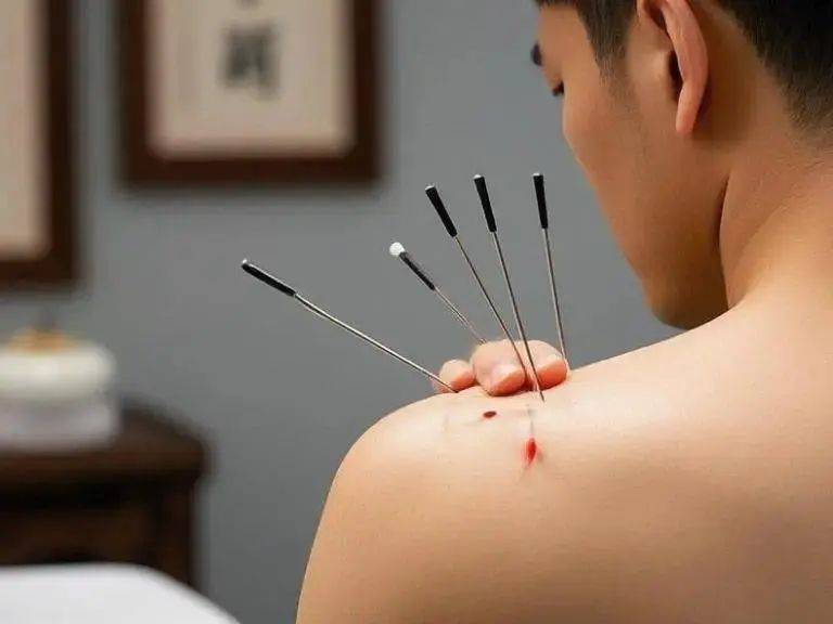 中医针灸教程实战手册：零基础也能掌握的关键点