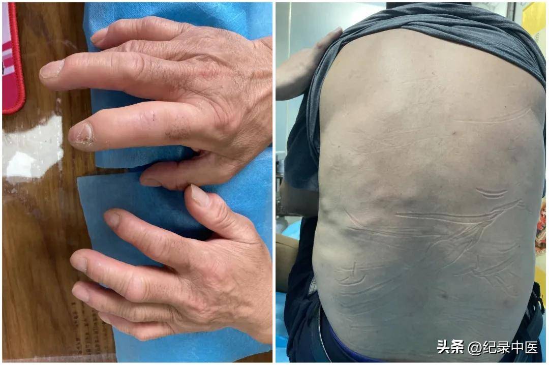 中医按摩推拿视频_视频中医推拿按摩教程_中医推拿的视频