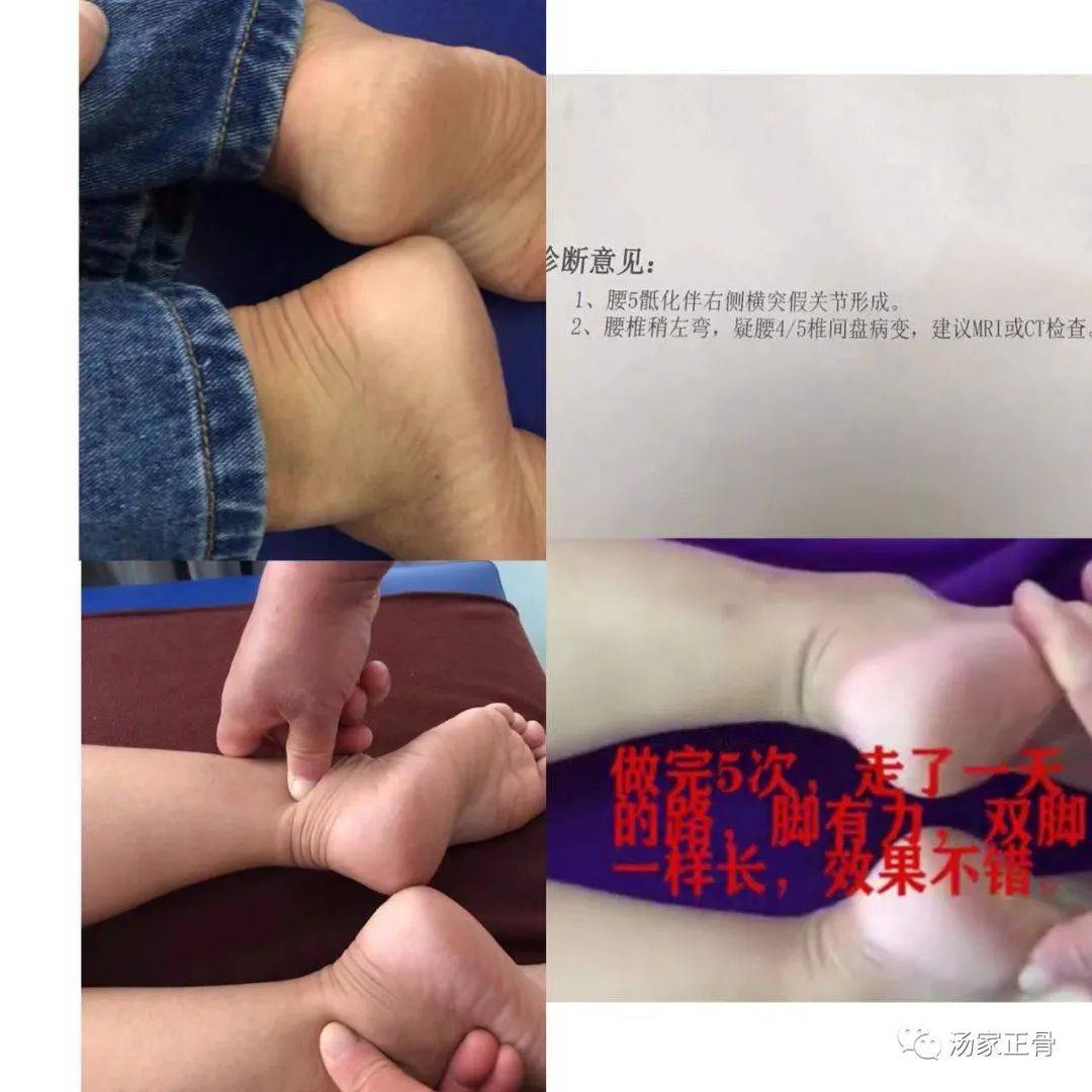 中医正骨大全视频播放_视频中医手法正骨教程_中医正骨视频手法视频