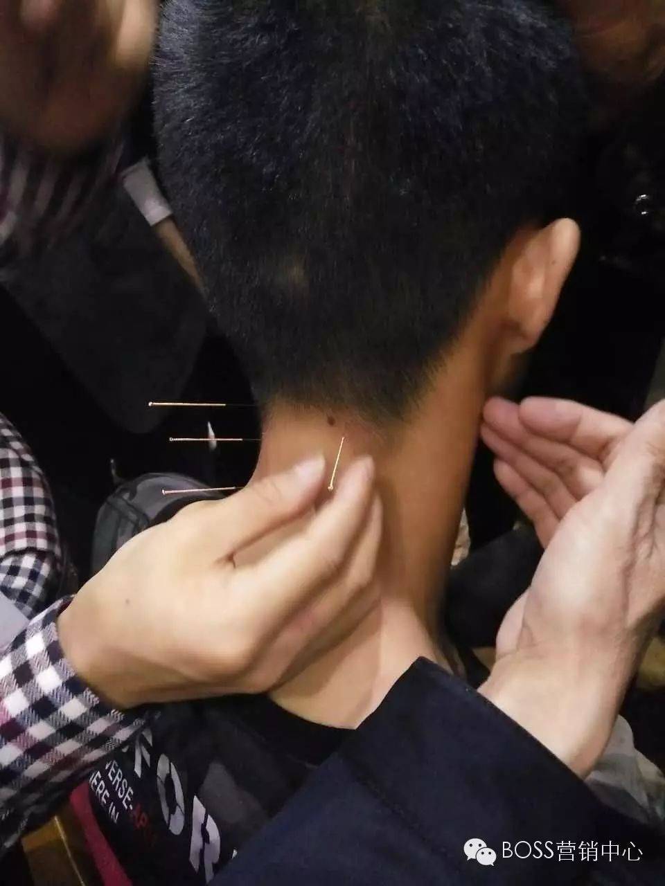 中医针灸视频教学全集_中医针灸视频教程90集_中医针灸学视频教学