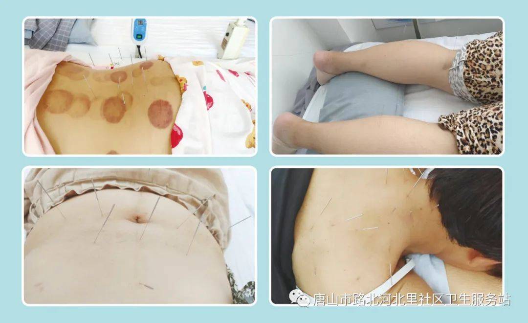 减肥针灸视频教学视频教程_中医针灸减肥视频大全_中医针灸减肥视频
