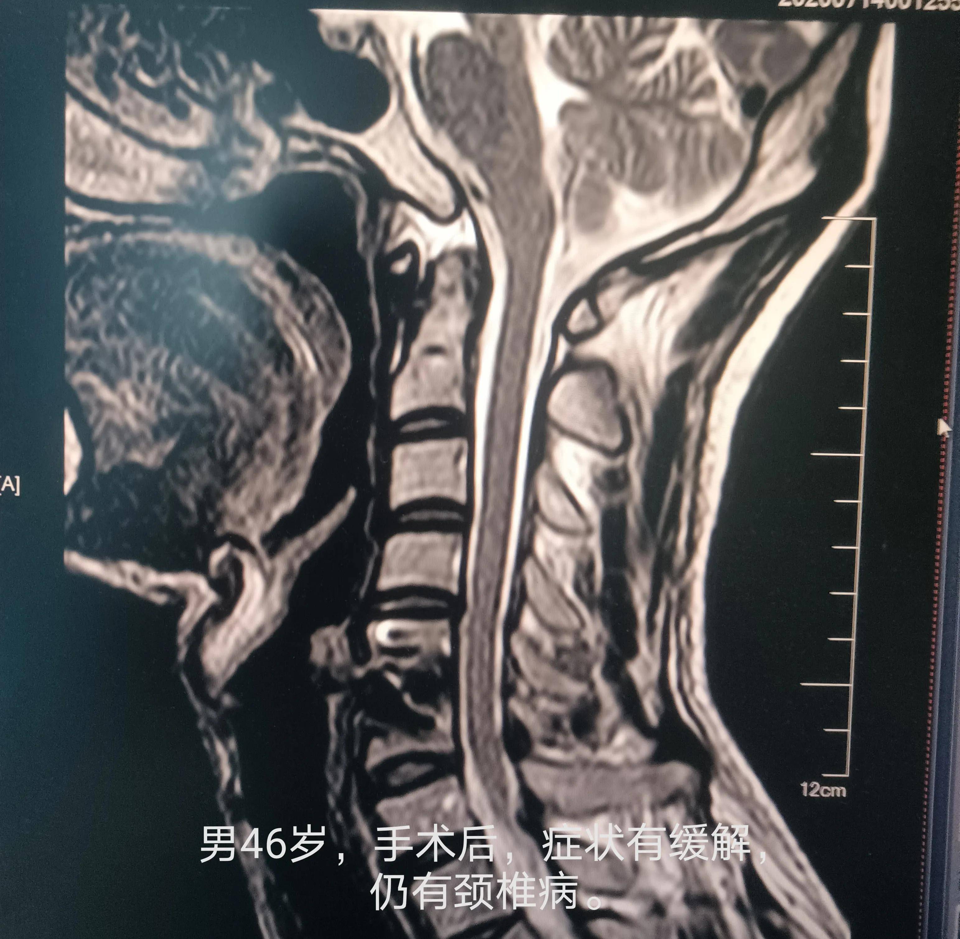 中医颈椎按摩手法视频_中医颈椎按摩推拿手法视频_中医按颈椎的手法视频