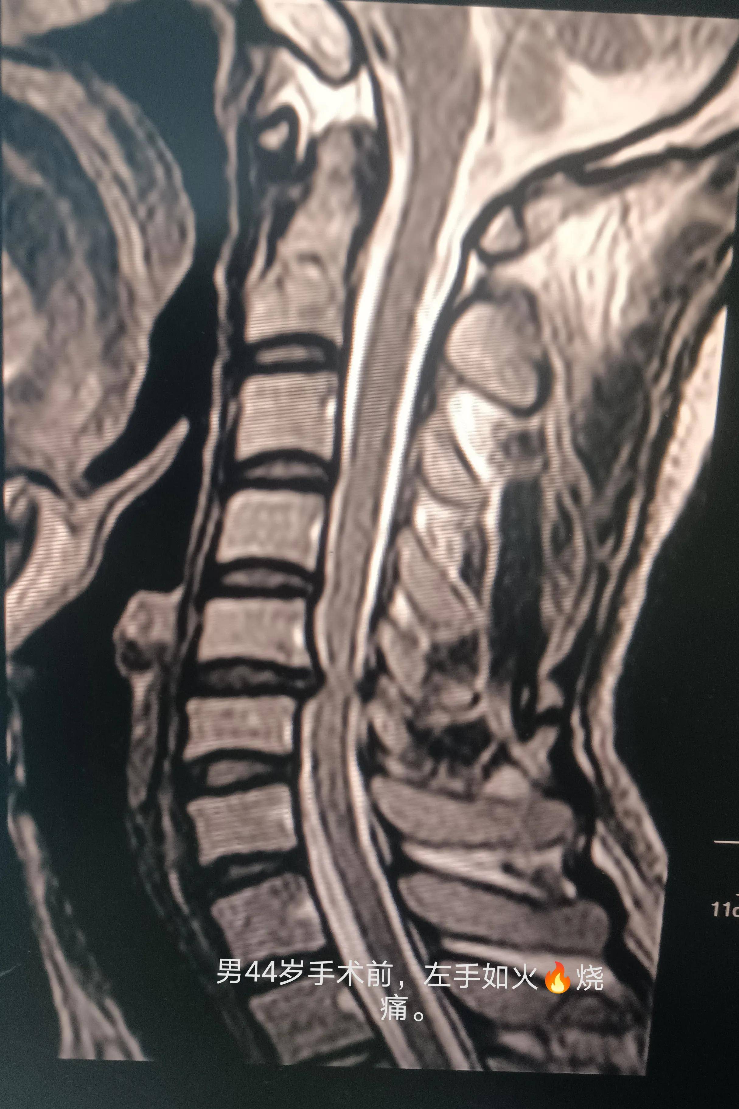 中医按颈椎的手法视频_中医颈椎按摩手法视频_中医颈椎按摩推拿手法视频