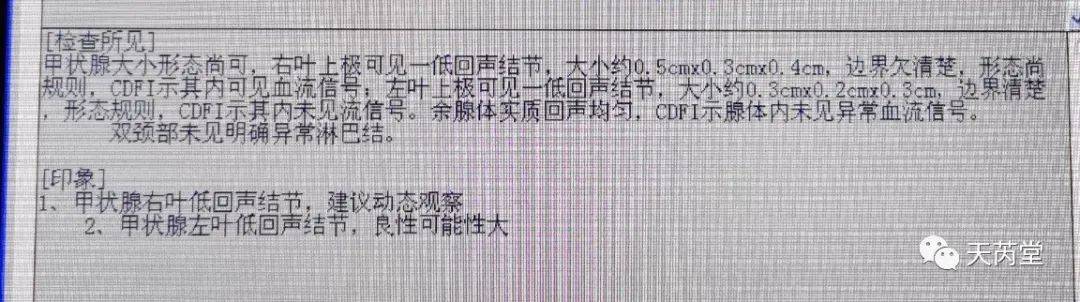 治疗甲状腺结节的中医专家_中医甲状腺结节治疗名医有哪些_治疗甲状腺结节中医名方