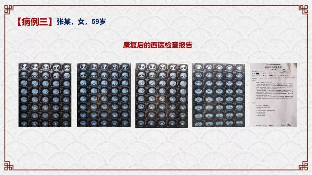 学中医主要学哪些东西_学中医主要学什么_中医学主要学什么