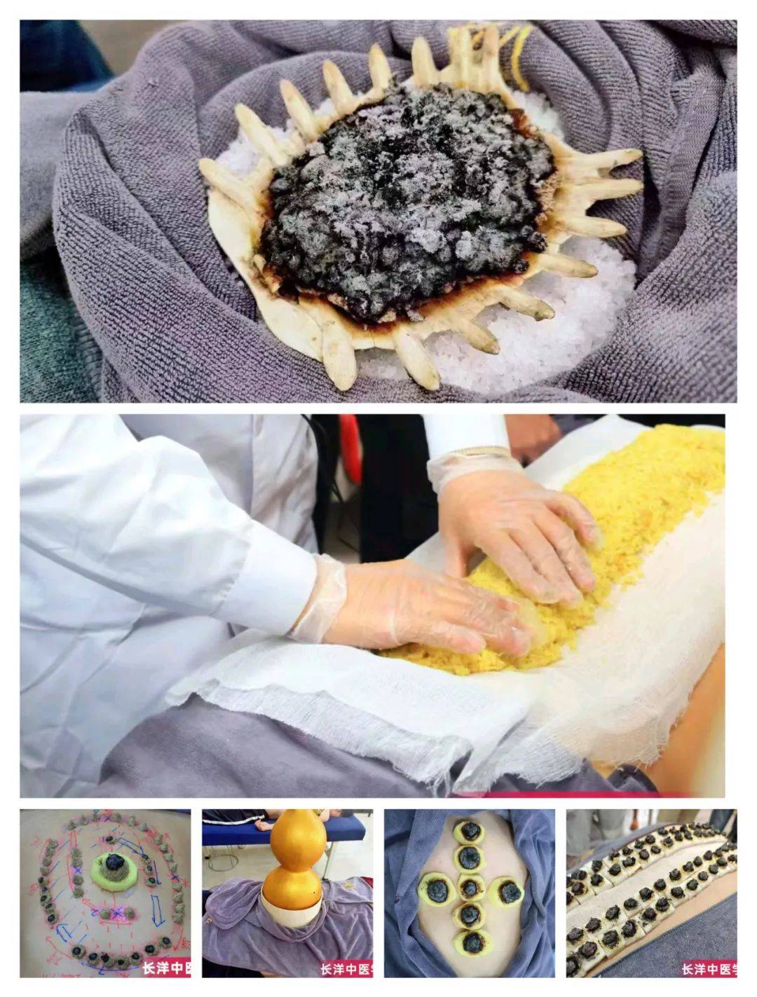 学中医针灸推拿的工作好找吗_学中医针灸推拿好就业吗_中医学和针灸推拿学