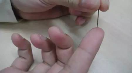 过敏性皮炎中医偏方_过敏皮炎中药方_过敏中医皮炎性偏方大全