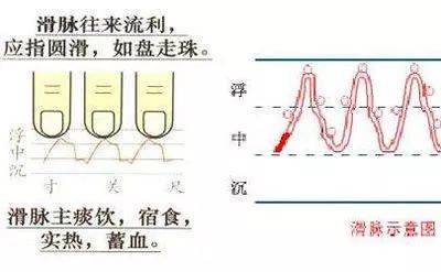 如何学中医诊脉入门_中医诊脉入门看什么书_中医脉诊从入门到精通
