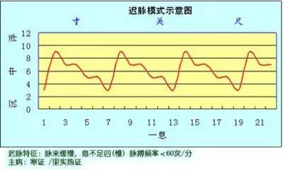 如何学中医诊脉入门_中医脉诊从入门到精通_中医诊脉入门看什么书