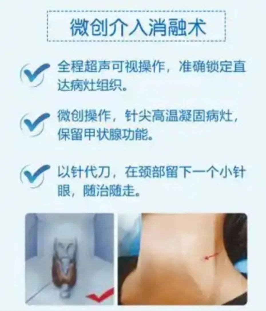 中医治疗甲状腺结节的中药方剂大全_中医中药治疗甲状腺结节验方_中医治甲状腺结节中药经验
