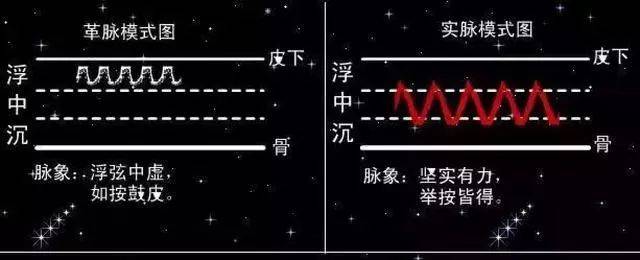 中医把脉图片真实_中医把脉图片大全大图_中医把脉图片