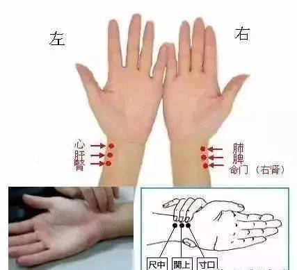中医把脉图片大全大图_中医把脉图片真实_中医把脉图片
