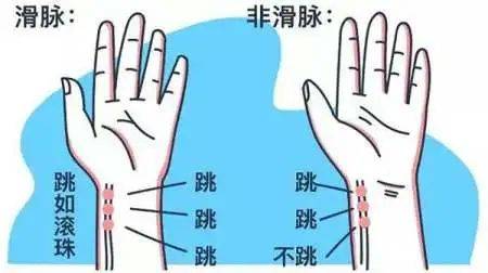 怀孕中医把脉多久能看到_怀孕中医把脉多久能看到_怀孕中医把脉能看到吗