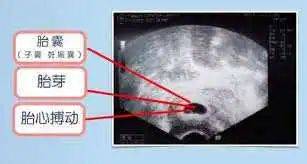 怀孕中医把脉多久能看到_怀孕中医把脉能看到吗_怀孕中医把脉多久能看到