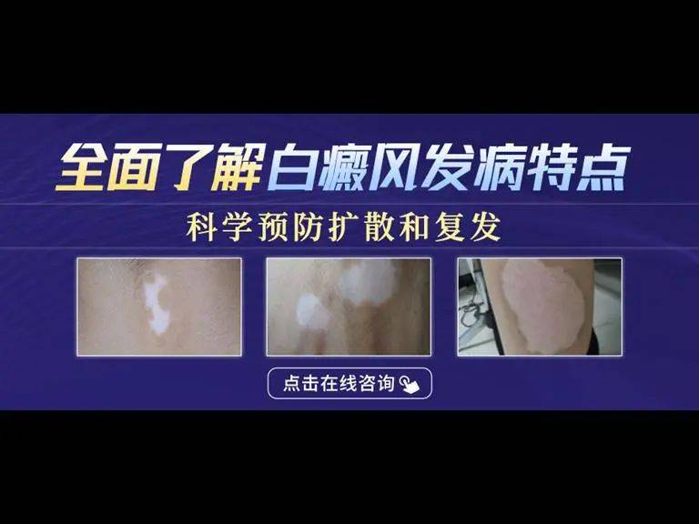 中医苏州哪家好_苏州好的中医_苏州中医哪里好