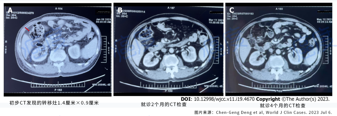 中医治疗癌症_癌症中医治疗最权威的医院_癌症中医治疗的最好方法