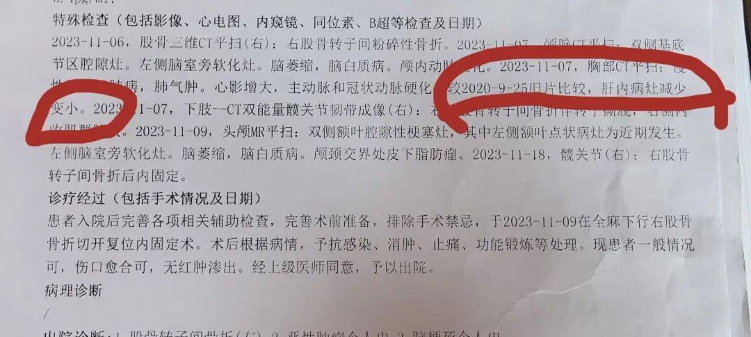中医治疗肝癌_中医肝癌治疗三部曲_中医肝癌治疗济南