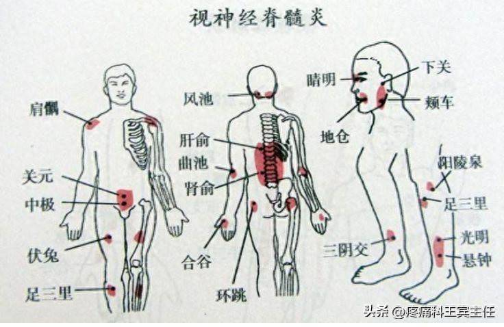 中医冶疗腰椎间盘突出_中医医治腰椎间盘突出_中医治疗腰椎间盘突出症