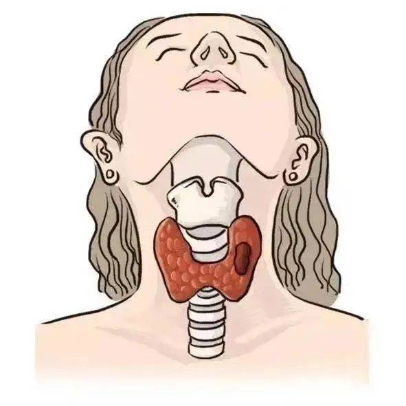 哪里有治甲状腺有结节的中医_中医治甲状腺结节哪家医院好_有中医治甲状腺结节吗