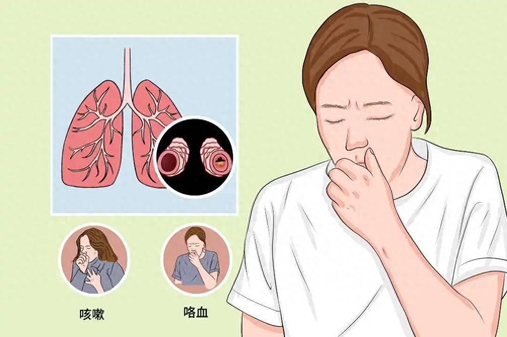 支气管扩张中医处方_中医治疗支气管扩张_扩张中医气管支治疗效果好吗