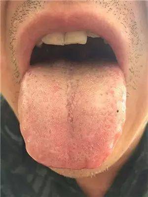 中医药治疗皮肤病_中医治疗皮肤病_中医病治疗皮肤病的方法