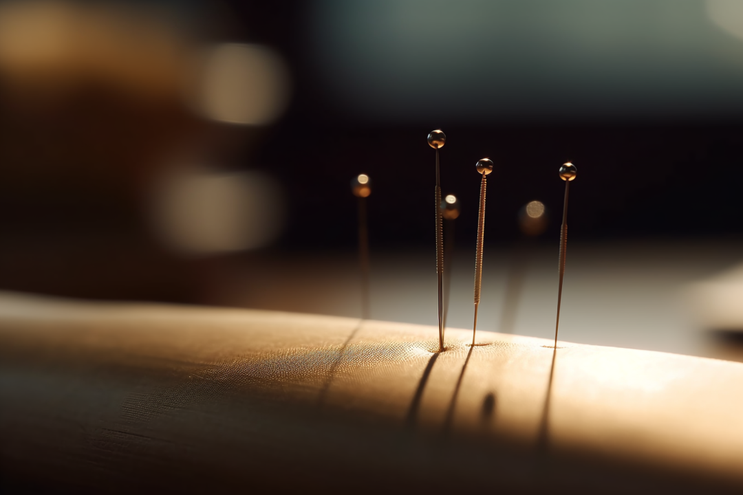 网球肘中医方剂_网球肘的中医疗法_中医治疗网球肘