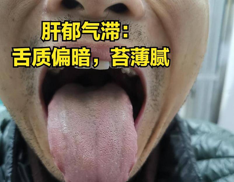 中医症状郁结肝气不足_中医的肝气郁结_中医肝气郁结的症状