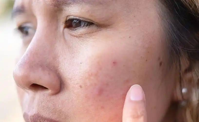 气血足表现的症状_中医气血不足的症状_中医里气血足的人有什么表现
