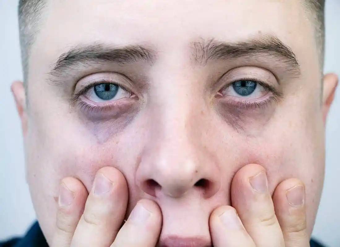 中医气血不足的症状_气血足表现的症状_中医里气血足的人有什么表现