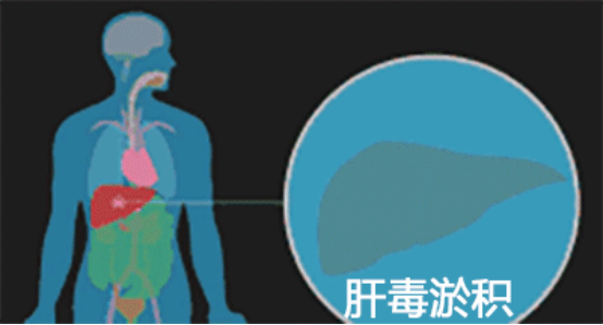 中医肝胆湿热的症状_中医症状湿热肝胆阴虚_肝胆湿热的中医论治