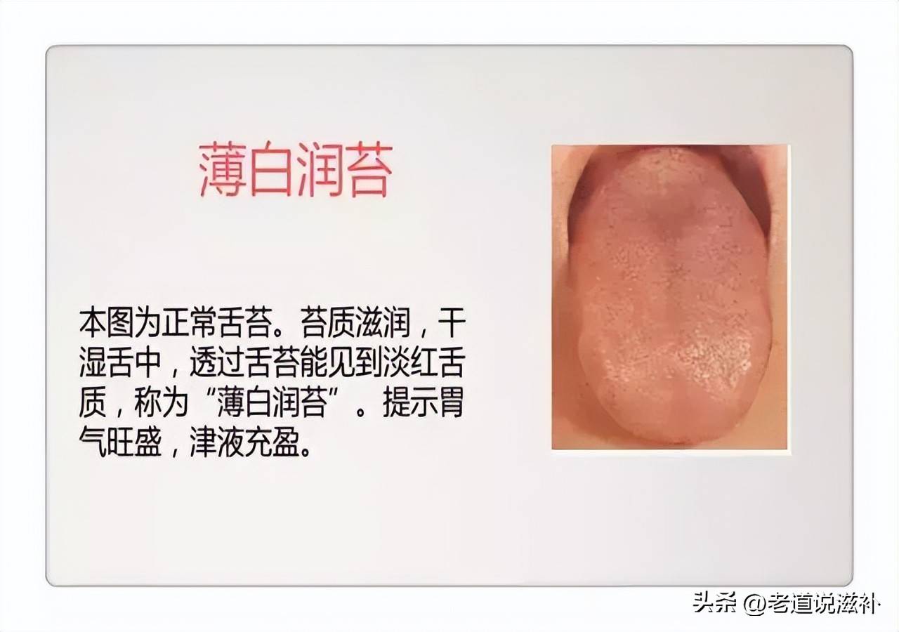中医症状对照表_中医舌诊图片及症状_中医症状分类