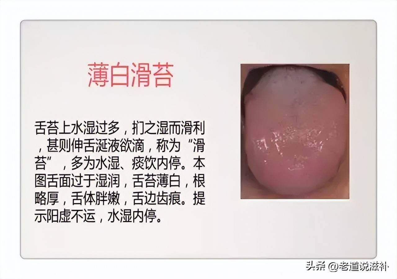 中医症状对照表_中医症状分类_中医舌诊图片及症状