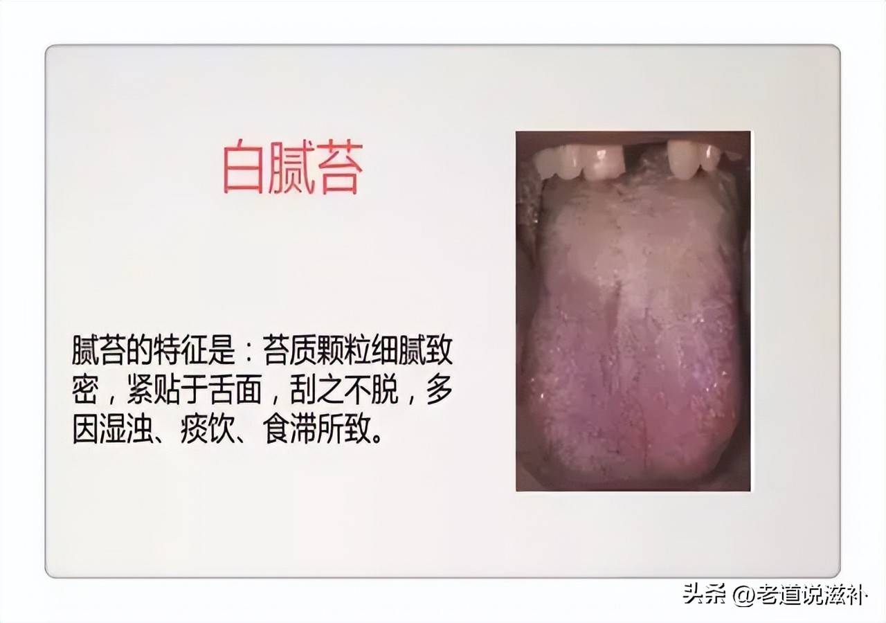 中医症状对照表_中医症状分类_中医舌诊图片及症状