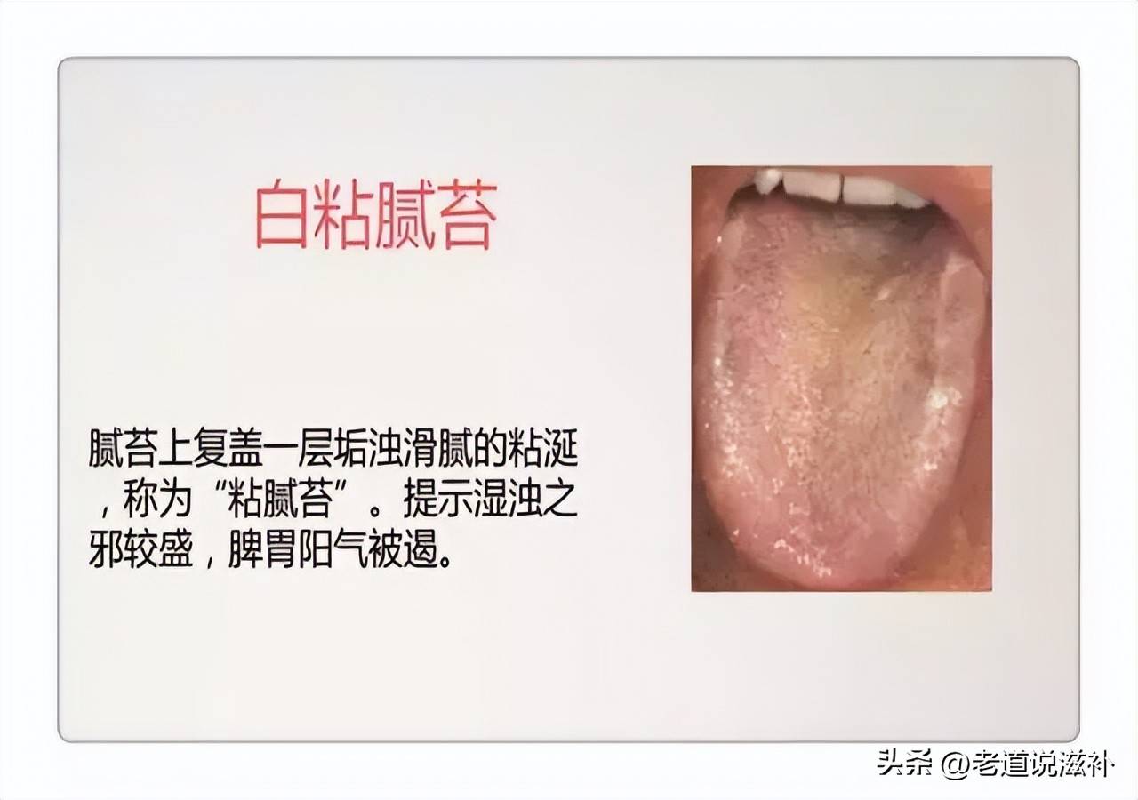 中医舌诊图片及症状_中医症状对照表_中医症状分类