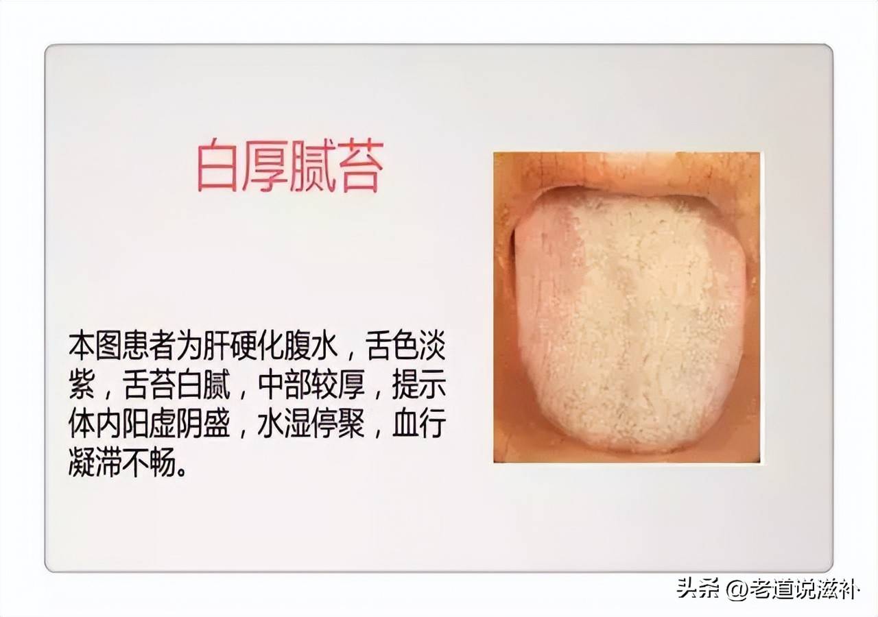 中医舌诊图片及症状_中医症状对照表_中医症状分类