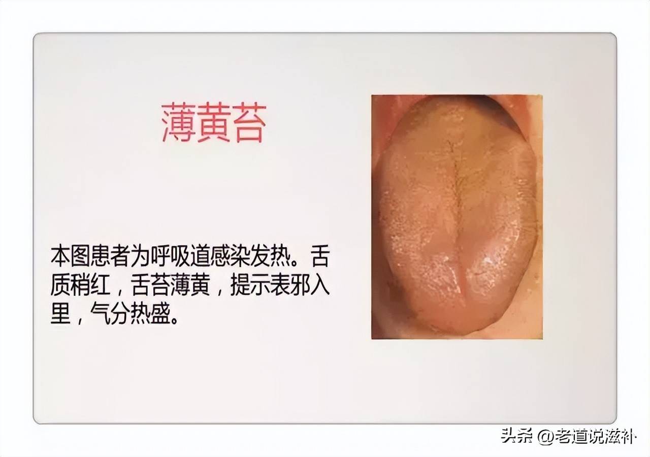 中医症状对照表_中医症状分类_中医舌诊图片及症状