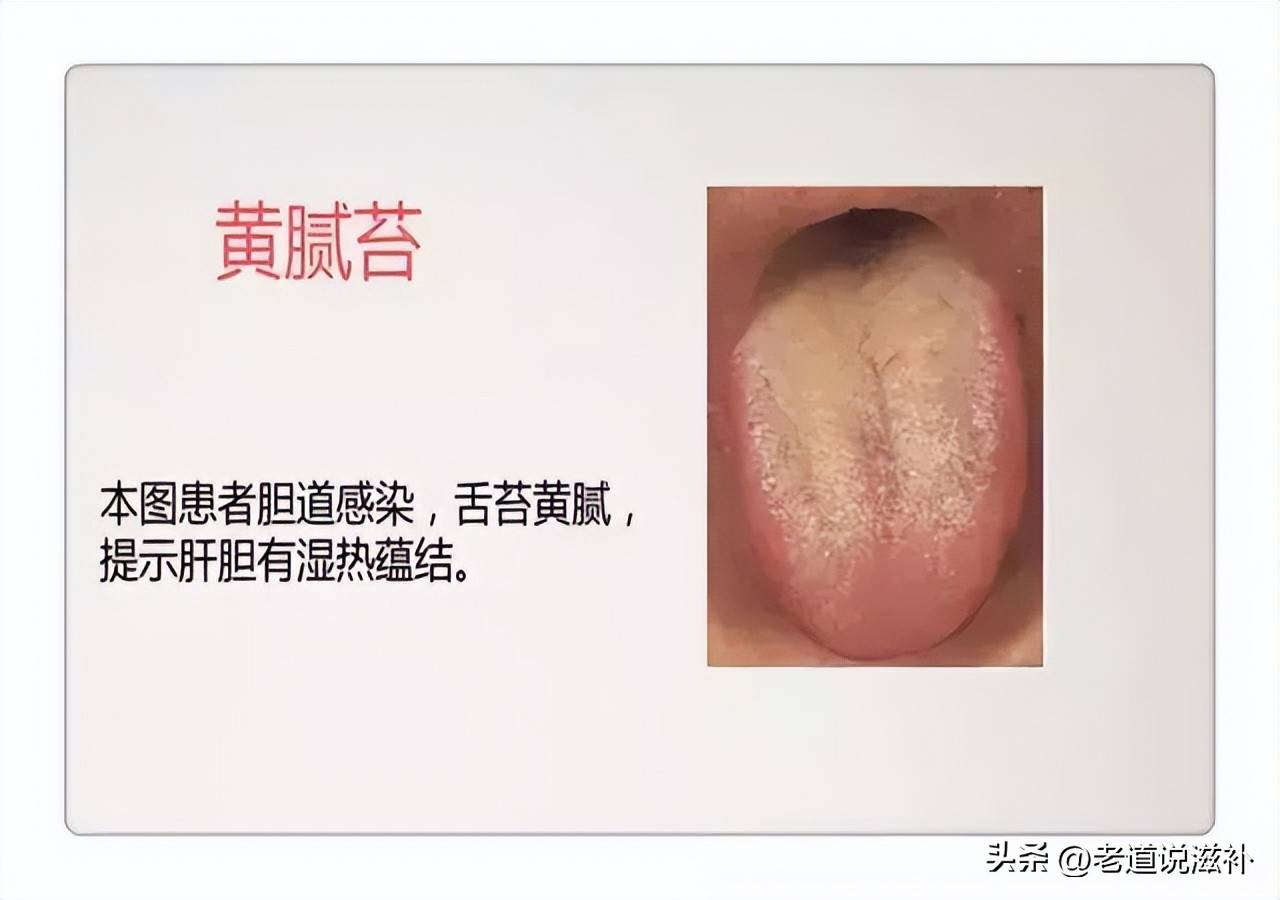 中医舌诊图片及症状_中医症状对照表_中医症状分类