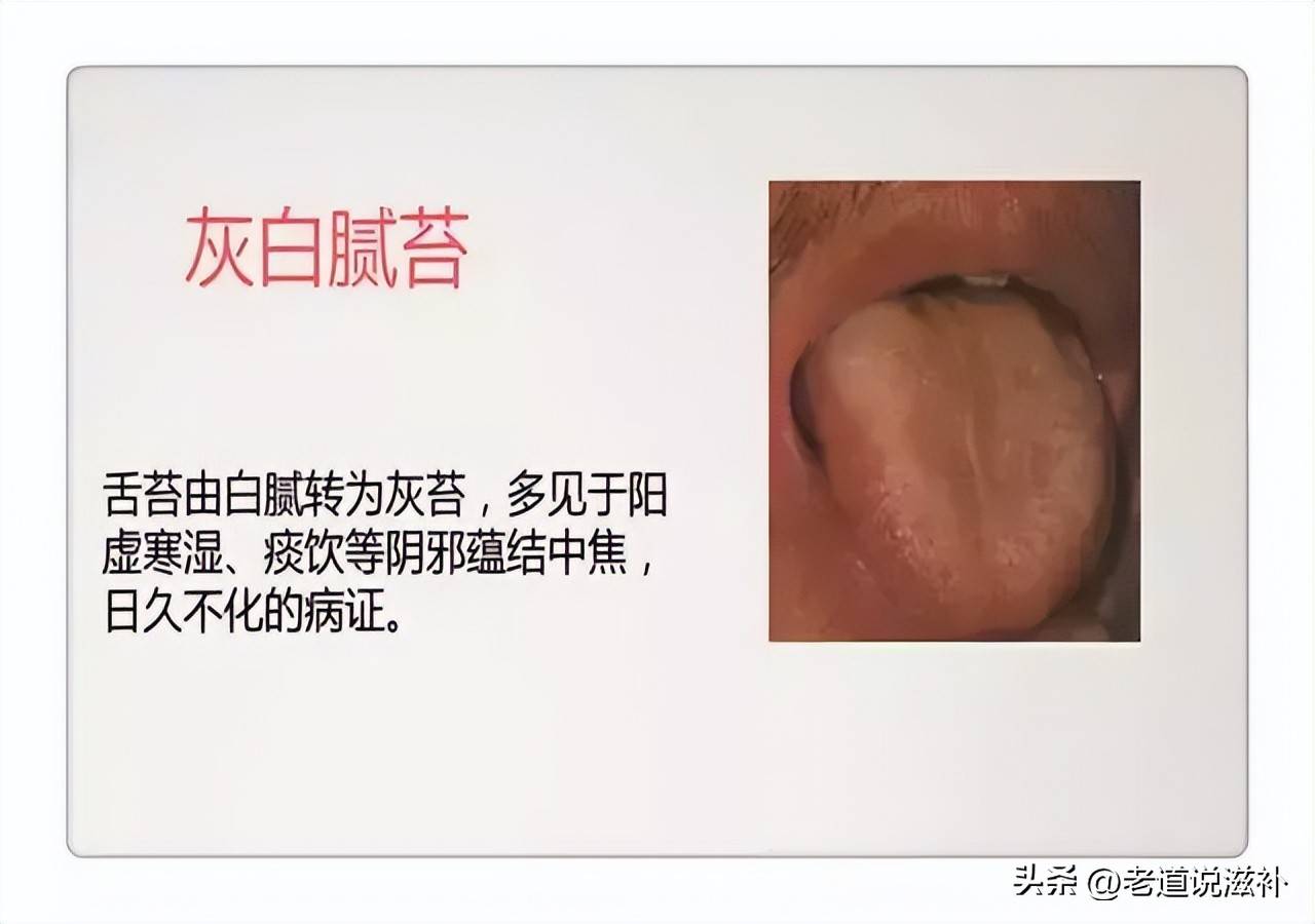 中医症状对照表_中医舌诊图片及症状_中医症状分类