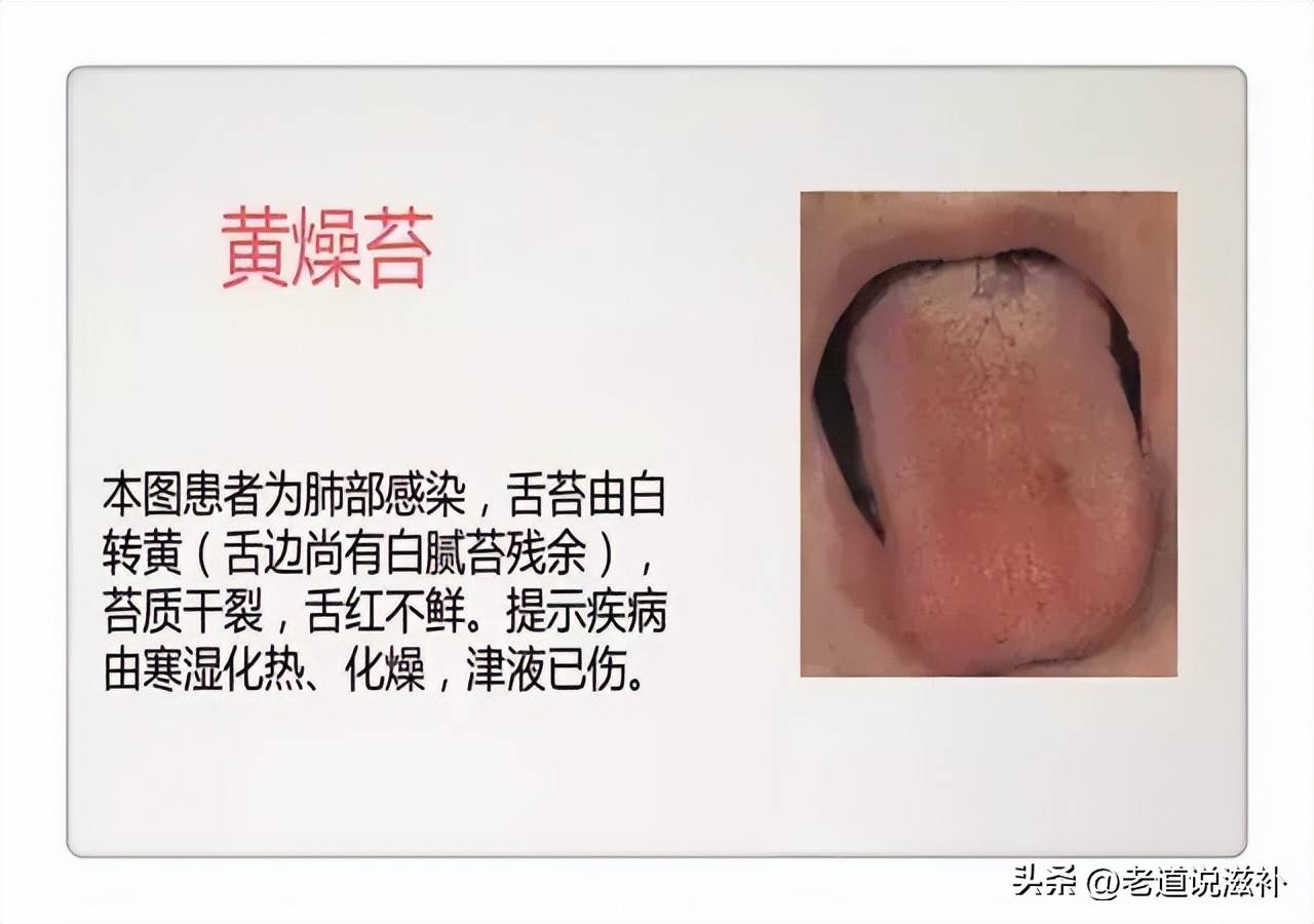 中医症状对照表_中医症状分类_中医舌诊图片及症状