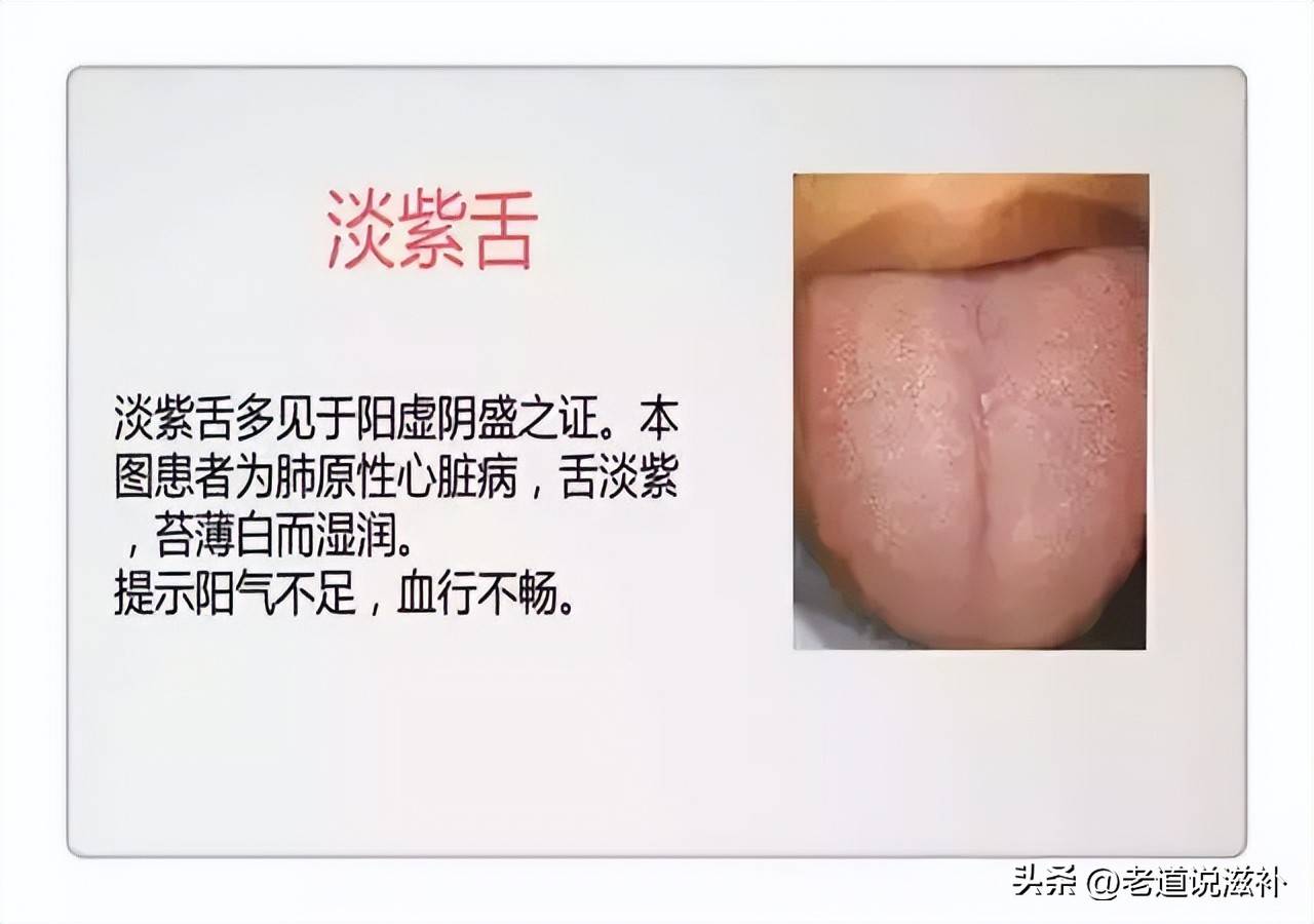 中医舌诊图片及症状_中医症状分类_中医症状对照表