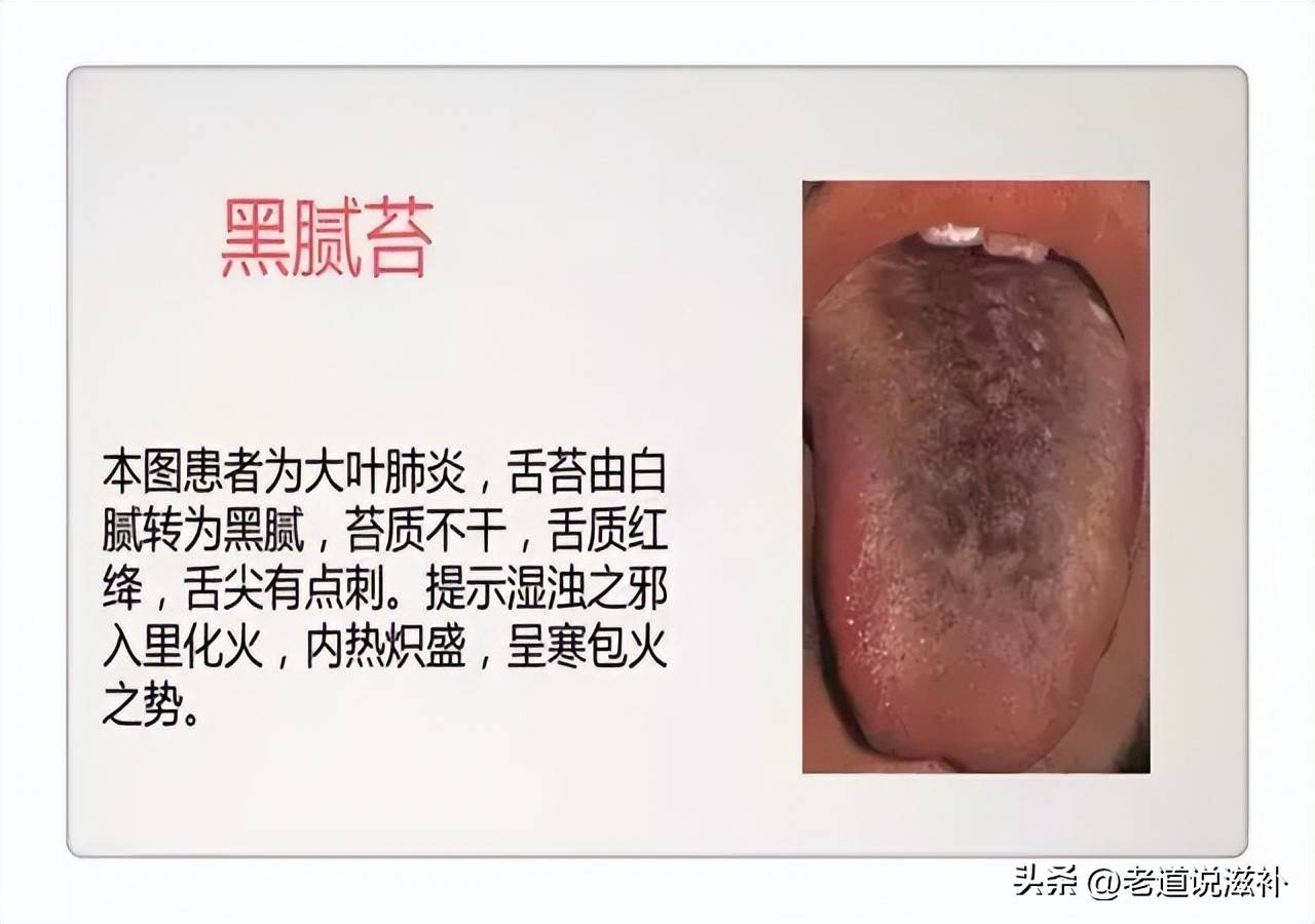 中医症状对照表_中医舌诊图片及症状_中医症状分类