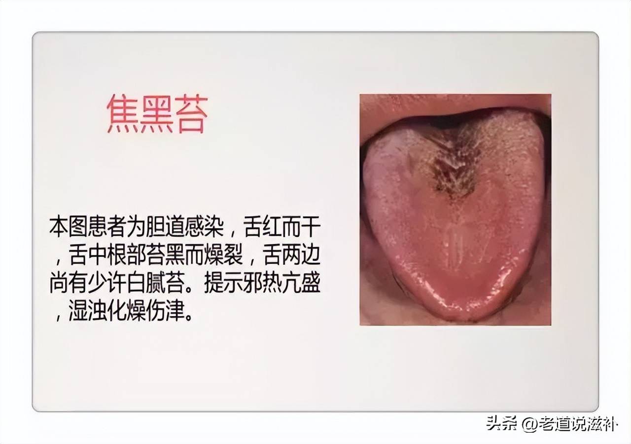 中医症状分类_中医症状对照表_中医舌诊图片及症状
