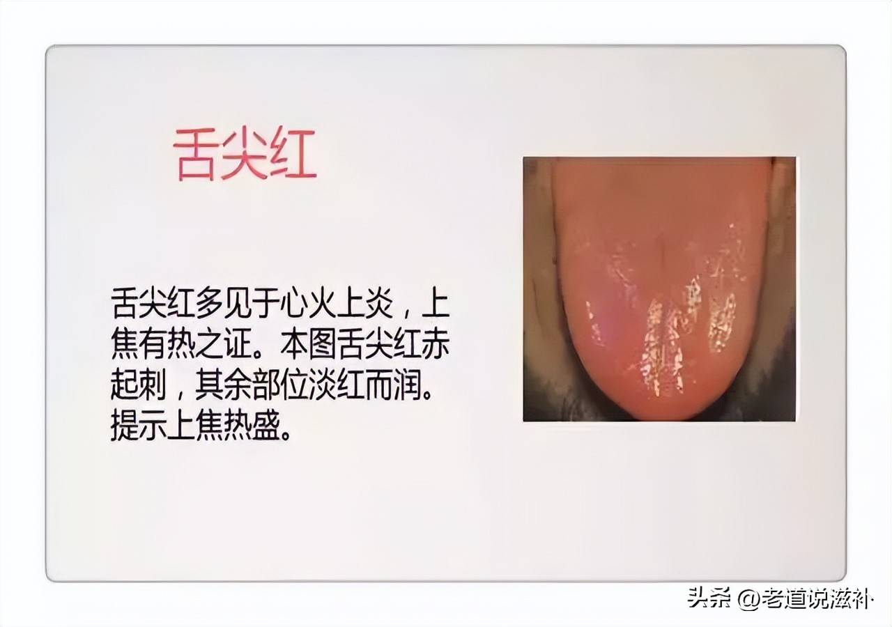 中医症状分类_中医症状对照表_中医舌诊图片及症状