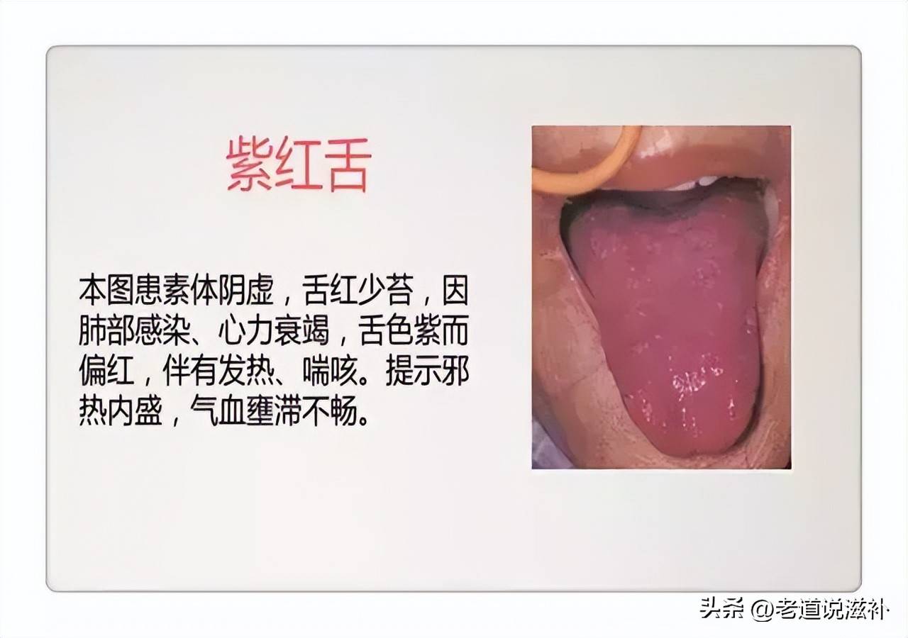 中医症状对照表_中医症状分类_中医舌诊图片及症状