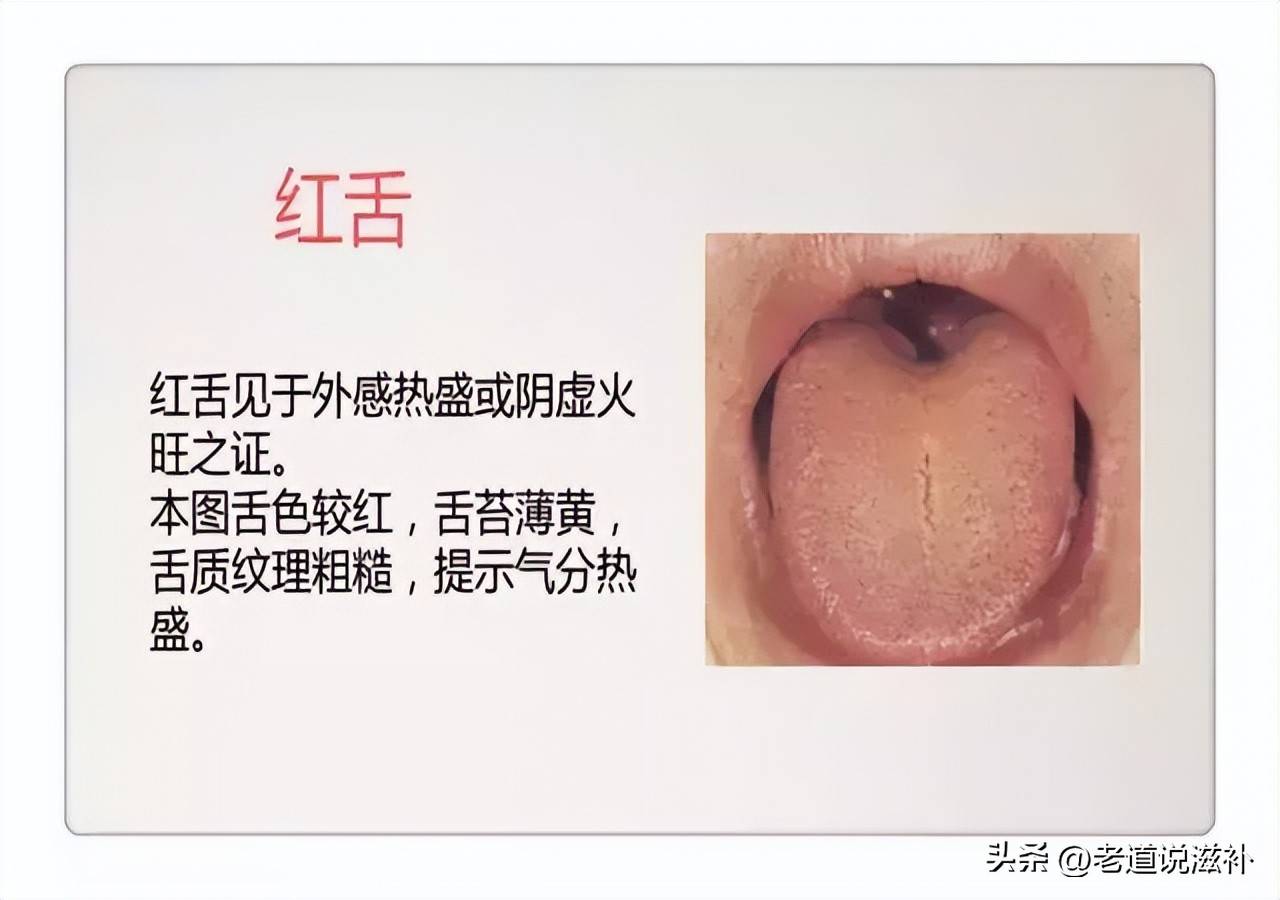 中医舌诊图片及症状_中医症状对照表_中医症状分类