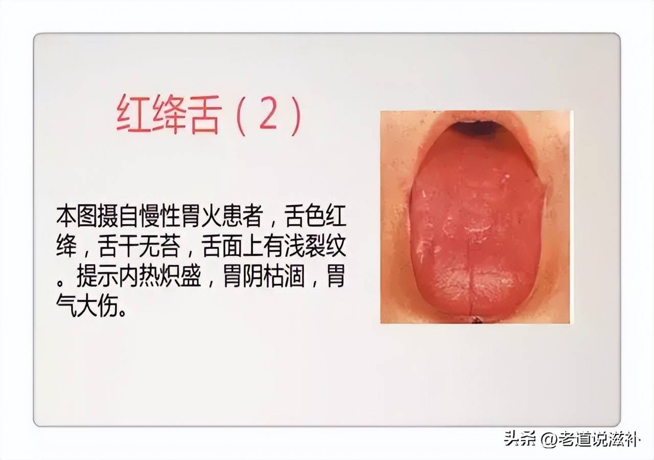 中医舌诊图片及症状_中医症状对照表_中医症状分类