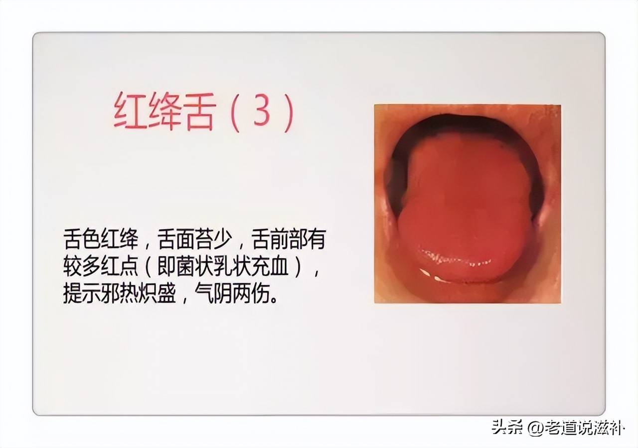 中医症状分类_中医症状对照表_中医舌诊图片及症状