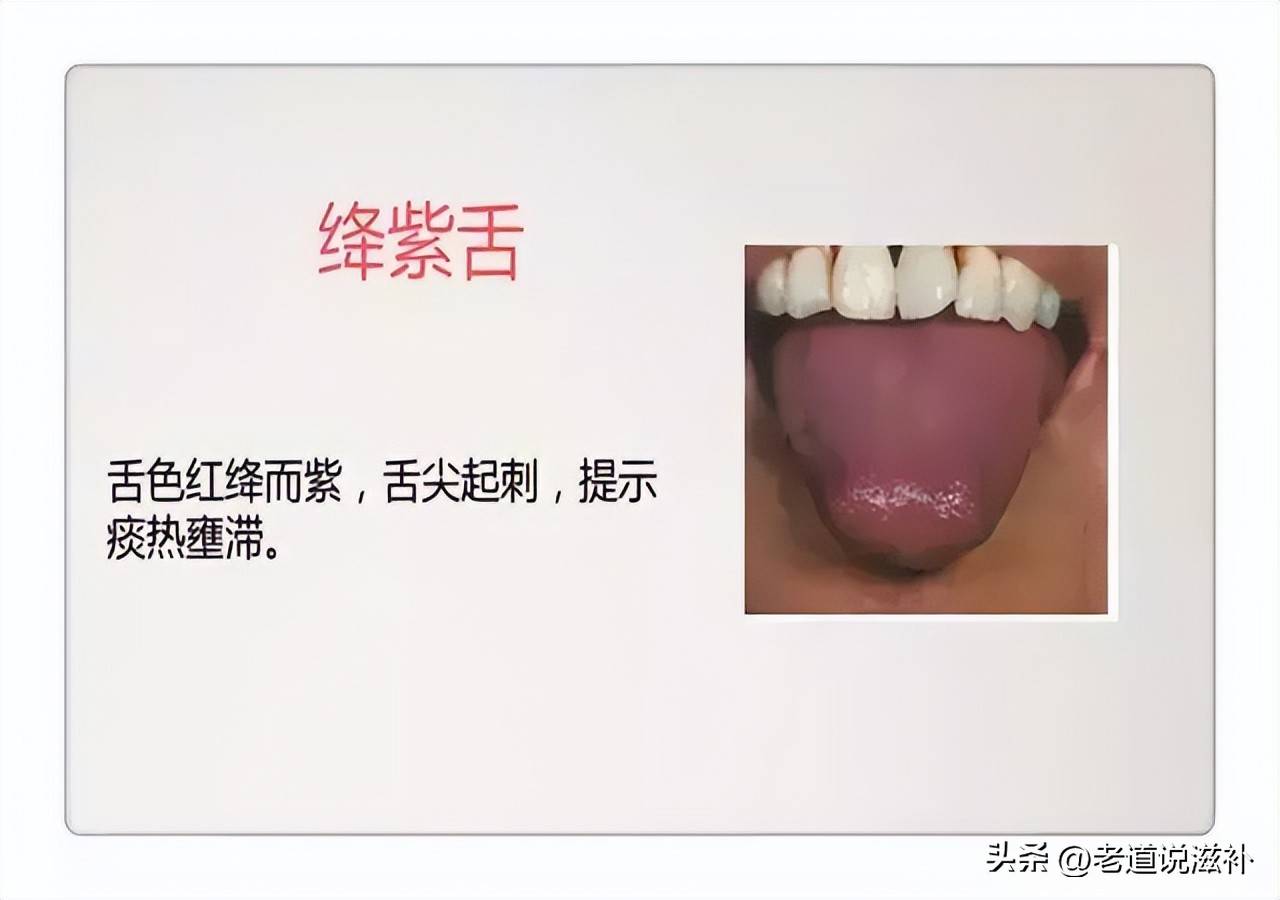 中医症状对照表_中医舌诊图片及症状_中医症状分类