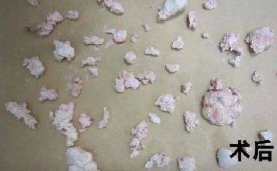 中医疗法风湿类有哪些_类风湿的中医疗法_风湿类风湿中医疗法