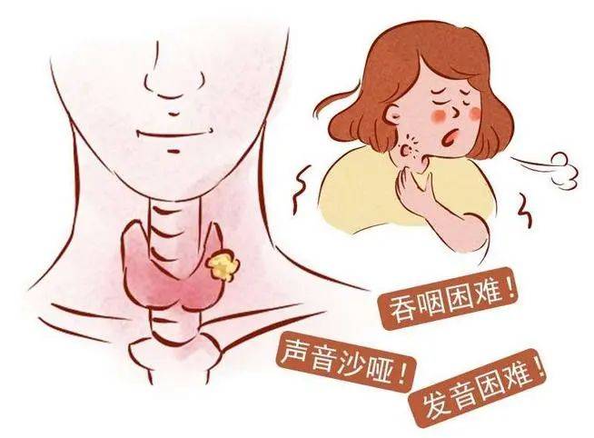 中医对甲状腺结节的治疗效果_中医论治甲状腺结节_甲状腺结节中医疗法